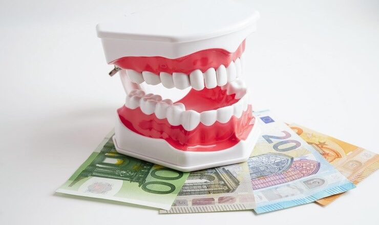 Tout ce que vous devez savoir sur le bridge dentaire tarif : Guide complet pour un sourire au top !