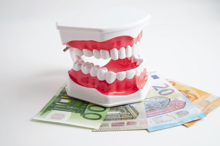 Tout ce que vous devez savoir sur le bridge dentaire tarif : Guide complet pour un sourire au top !