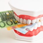 Combien Coûte un Blanchiment des Dents : Le Guide Ultime pour un Sourire de Star !