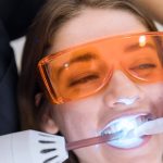Tout ce que vous devez savoir sur le blanchiment de dents prix : Votre guide pour un sourire éclatant