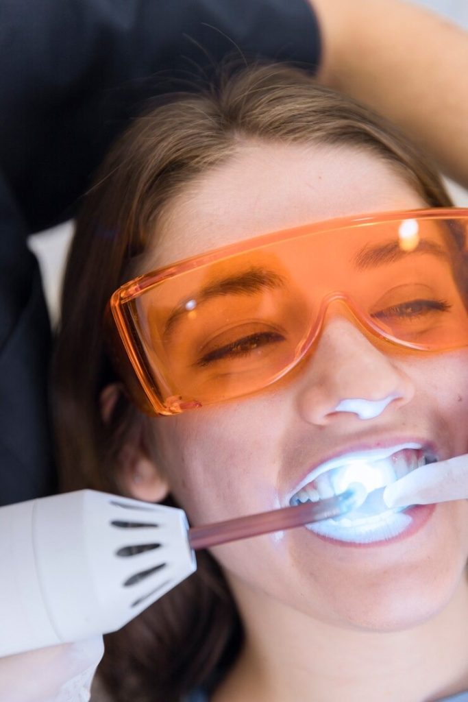 Tout ce que vous devez savoir sur le blanchiment de dents prix : Votre guide pour un sourire éclatant