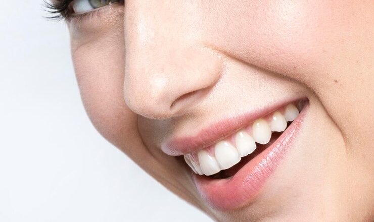 Blanchiment de dents : Le guide ultime pour un sourire éclatant en 2025