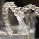 Comment obtenir un sourire éclatant avec le peroxyde d’hydrogène pour le blanchiment dentaire