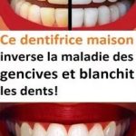 Que faire quand t’as mal aux dents et que t’as familident en tête ?