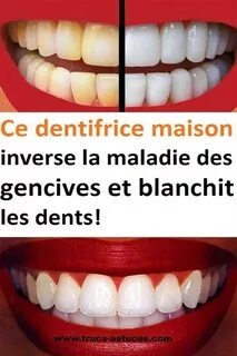 Que faire quand t’as mal aux dents et que t’as familident en tête ?