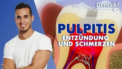 As-tu déjà eu une rage de dents qui te fait grimper aux murs ?