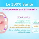 Comment trouver un dentiste 100 santé qui te convient vraiment ?