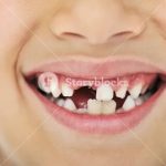 Vous vous demandez ce qui se passe quand les dents de lait de vos enfants tombent ?