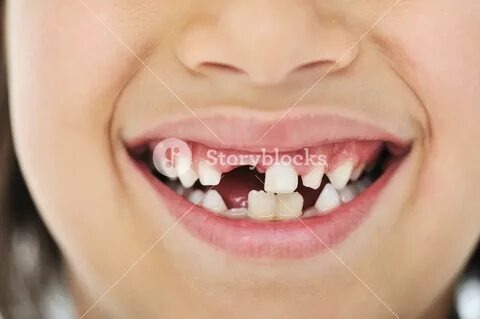 Vous vous demandez ce qui se passe quand les dents de lait de vos enfants tombent ?