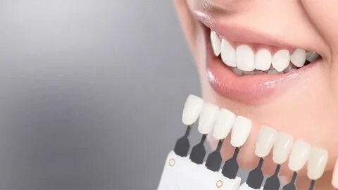 Envie d’un sourire qui claque ? Prends un rdv blanchiment dentaire !
