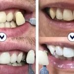 Soulager une rage de dent et sublimer votre sourire : astuces, matériel de dentiste et blanchiment des dents