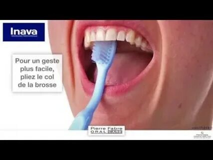 Tout ce que tu dois savoir sur les brosses à dents : ton guide ultime pour un sourire éclatant