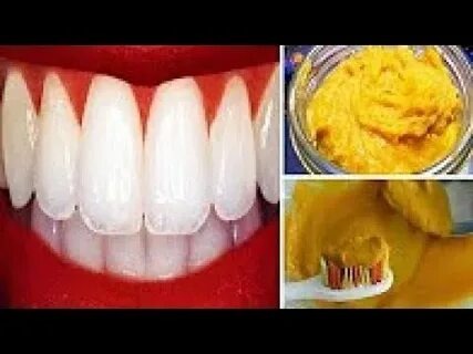 Comment Blanchir Naturellement les Dents : Le Guide Ultime pour un Sourire Éclatant