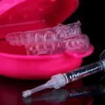 Tout ce que vous devez savoir sur la gouttière de blanchiment pour un sourire éclatant