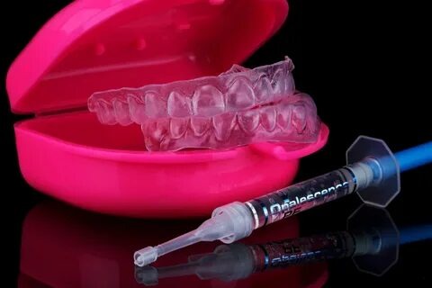 Tout ce que vous devez savoir sur la gouttière de blanchiment pour un sourire éclatant