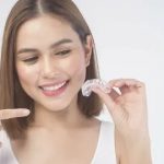Comment obtenir un sourire éclatant avec Invisalign et le blanchiment dentaire ?