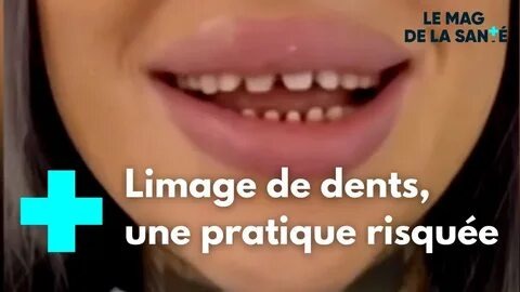 un mal de dent horrible