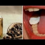 Comment soulager une rage de dent avec le clou de girofle : votre guide ultime pour un remède naturel