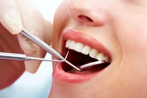 Tout ce que vous devez savoir sur le blanchiment dentaire au laser : Un sourire éclatant à portée de main