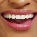 Tout ce que vous devez savoir sur le CEREC dentaire : Prix, avantages et bien plus !