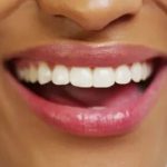 Tout ce que vous devez savoir sur le CEREC dentaire : Prix, avantages et bien plus !
