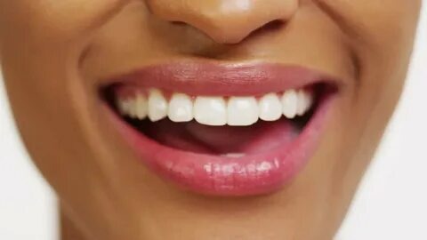 Tout ce que vous devez savoir sur le CEREC dentaire : Prix, avantages et bien plus !