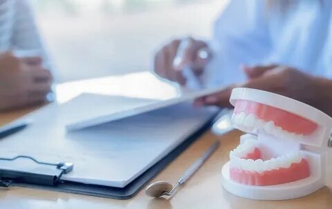 Pont fixe dentaire : Tout ce que tu dois savoir pour retrouver un sourire au top !